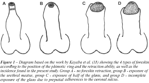 phimosis-stretching-image01.png